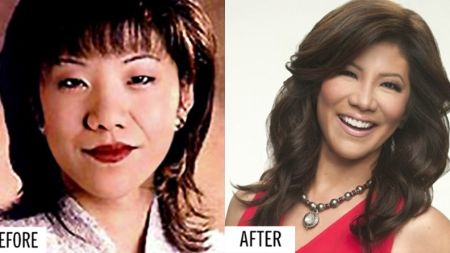 Julie Chen before and after Blepharoplasty.
